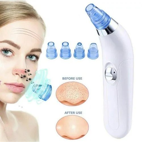 Blackheads Remover | Blackheads Extractor Derma Suction